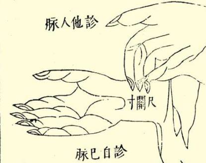 本草纲目·第三卷·百病主治·诸风具体内容是什么？历史图片