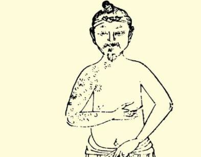 本草纲目历史图片