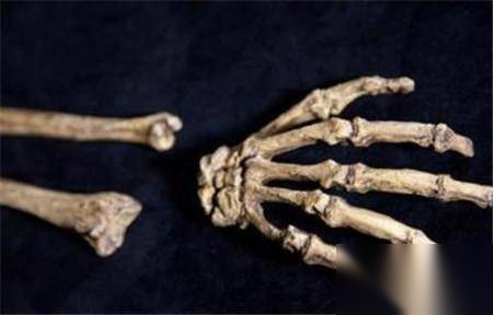 西班牙人颌骨历史图片