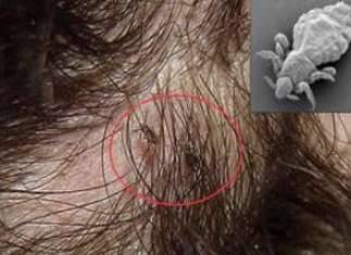 世上最小的微生物历史图片