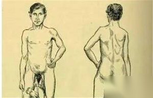 盘点人类世界十大怪胎 其中一个长了四条腿！