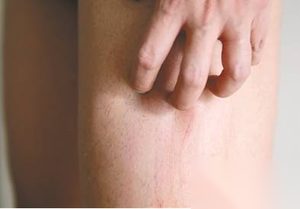 盘点人体的九大奇怪症状：皮肤奇怪瘙痒你有吗？
