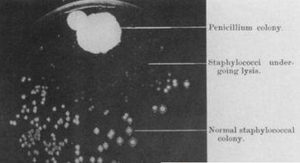 英国微生物学家弗莱明简介：巧合之下竟发现了青霉素