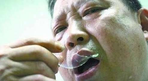 异食癖历史图片