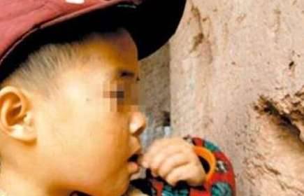 异食癖历史图片